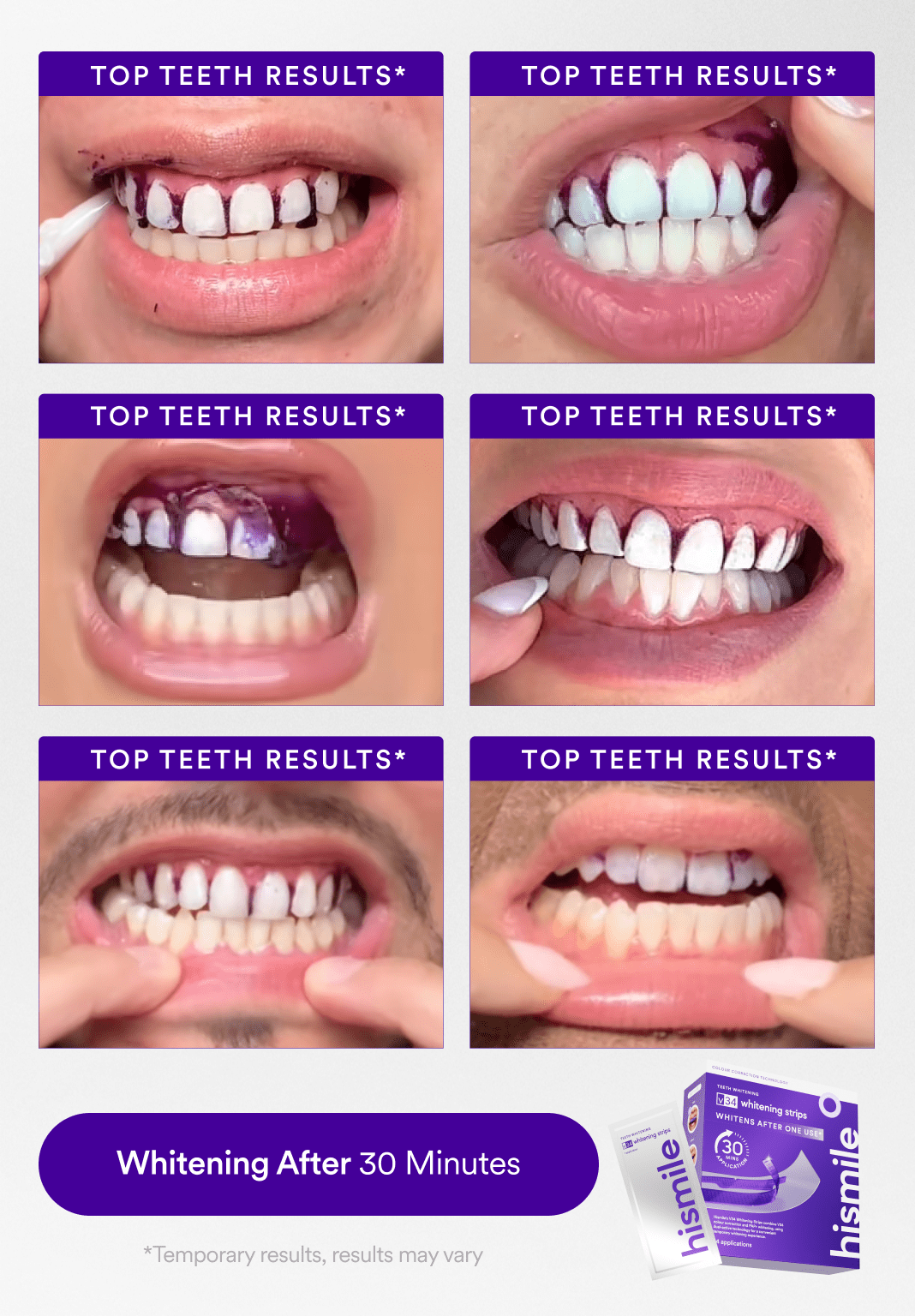 Affordable Whitening Set