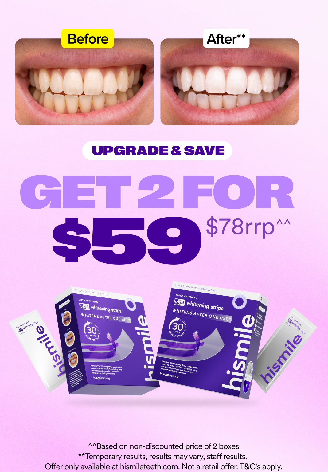 V34 Whitening Strips - Value 2 Pack