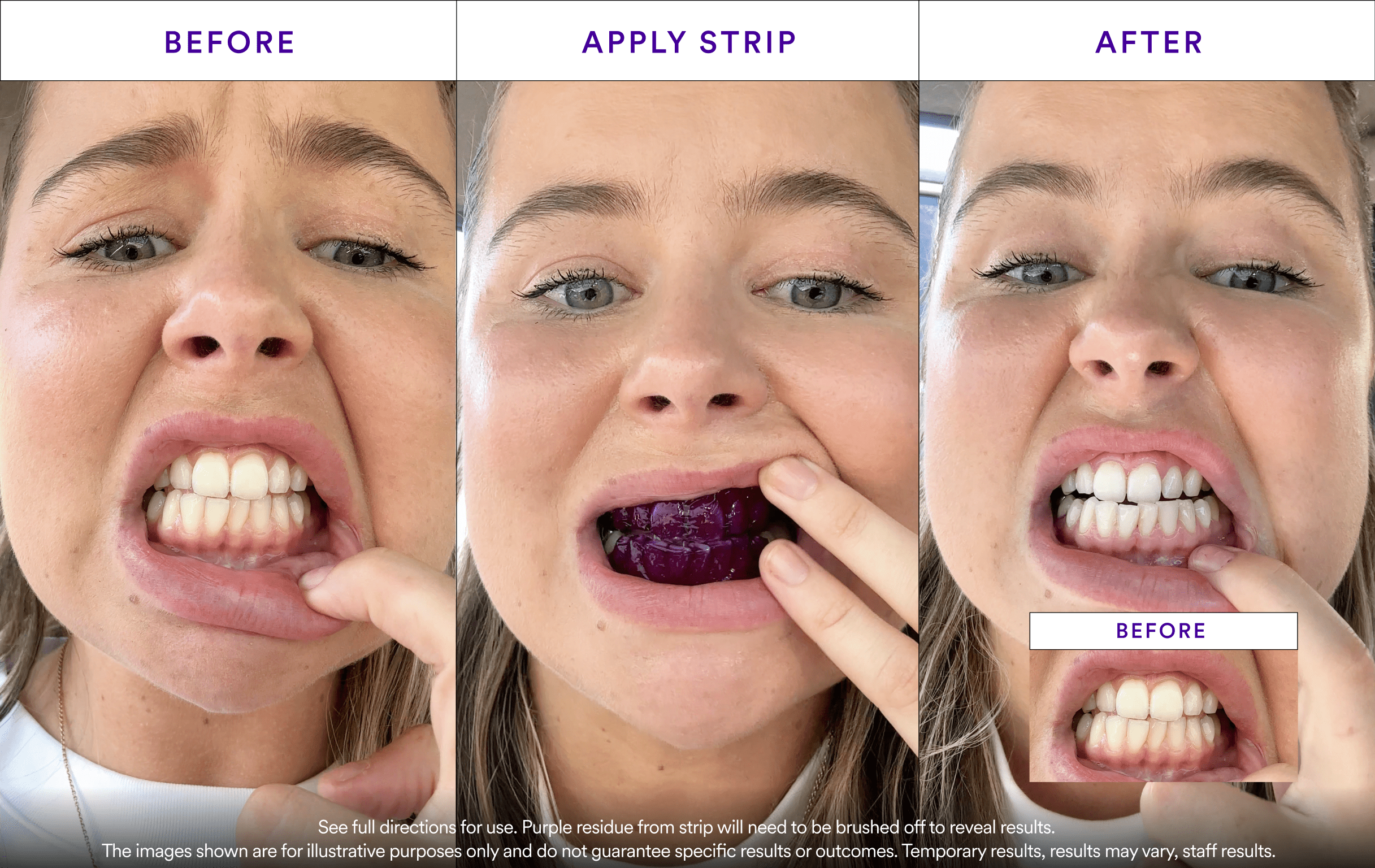 Affordable Whitening Set